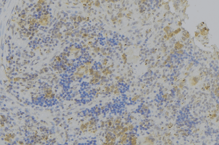 Polyclonal Rabbit anti-Human OLFM1 Antibody (IHC, WB)
