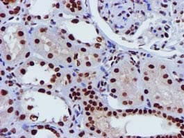GSTT2 Antibody (clone OTI3B6)
