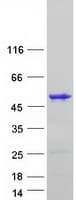 Human TBX1 Protein (Recombinant Myc-DDK (Flag))