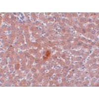 KDM3A / JMJD1A Antibody