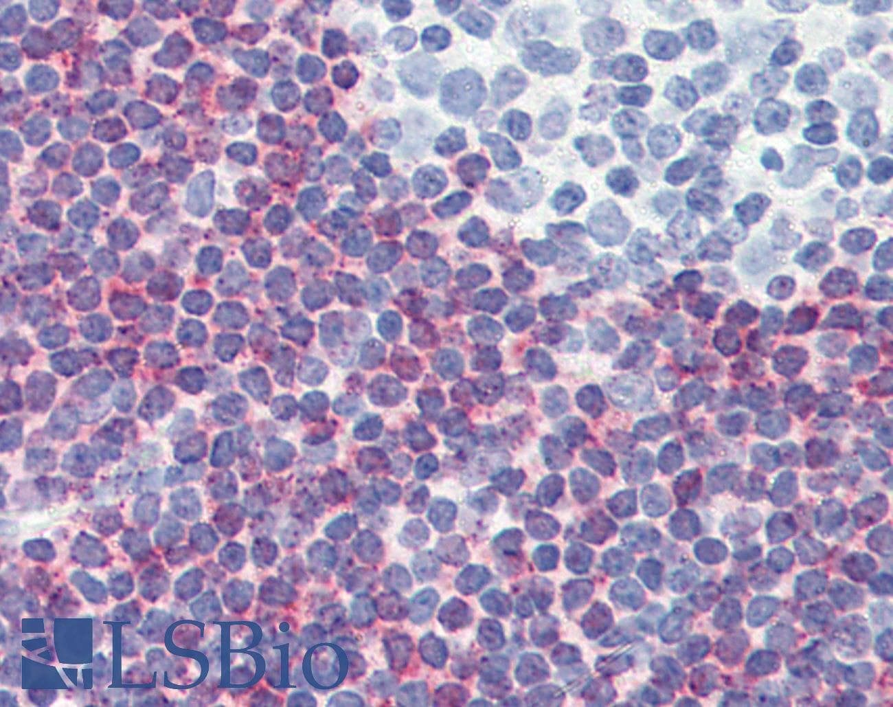 PathPlus™ PDCD4 Antibody (aa1-469, clone K4C1)