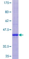 Human NDP Protein (Recombinant GST)