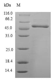 Human HCCS Protein (Recombinant GST, N-terminus)