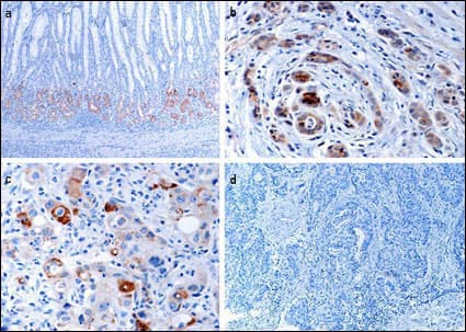 EPHB1 / EPH Receptor B1 Antibody (aa955-984)