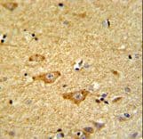 Polyclonal Rabbit anti-Human OMD / Osteomodulin Antibody (aa234-263, IHC, WB)