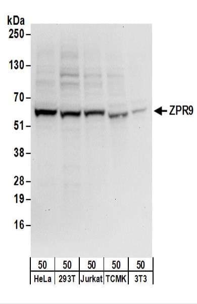 Polyclonal Rabbit anti-Human ZNF622 Antibody (aa25-75, WB)