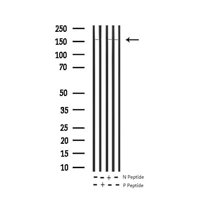 RET Antibody (phospho-Tyr1062)
