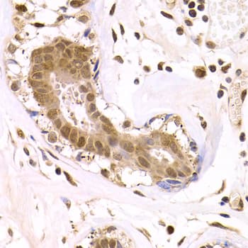 Polyclonal Rabbit anti-Human ODC1 / Ornithine Decarboxylase Antibody (IHC, WB)