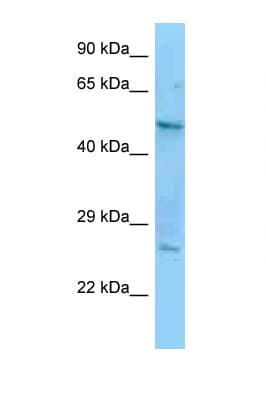 CRFR1 / CRHR1 Antibody (aa93-142)
