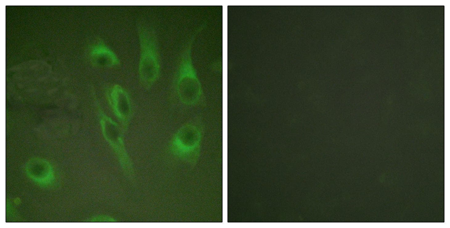 CANX / Calnexin Antibody (phospho-Ser583)