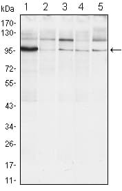 IHC-plus™ Monoclonal Mouse anti-Human ERN1 / IRE1 Antibody (clone 9F2, IHC, WB)