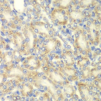 PRKAB2 / AMPK Beta 2 Antibody