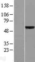SLC39A5 / ZIP5 Protein (Over-Expression Lysate Myc-DDK (Flag))