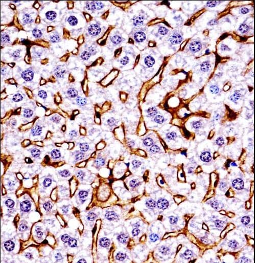 Polyclonal Rabbit anti-Mouse MST1R / RON Antibody (aa1013-1041, IHC, WB)