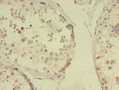 RBMY1F Antibody (aa1-496)