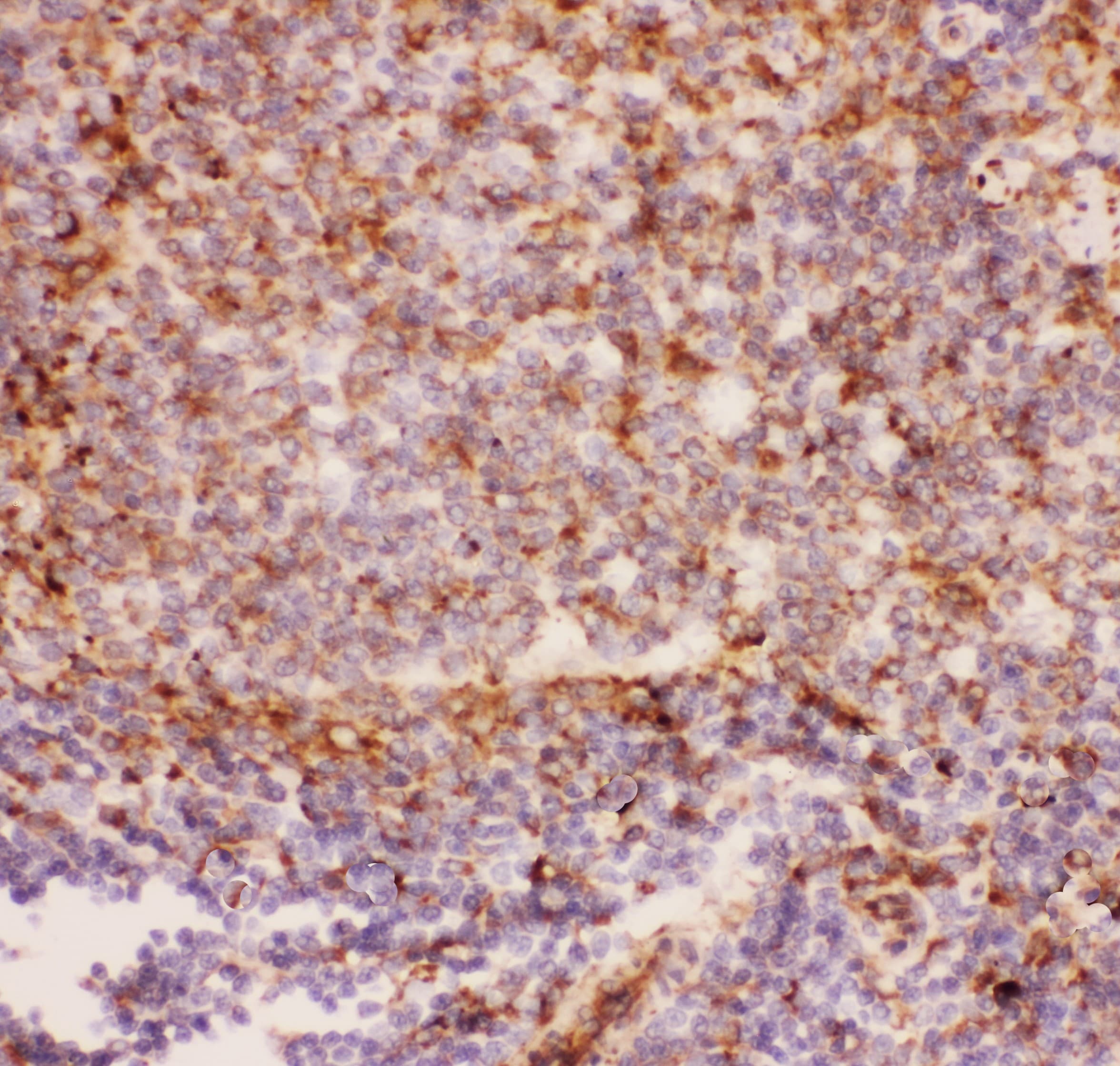 ITGAM / CD11b Antibody (aa17-382)