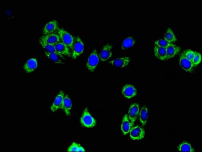 ACAA2 Antibody
