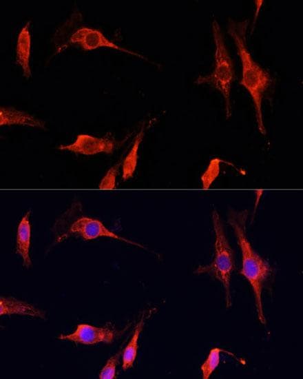 DNASE1 / DNase I Antibody