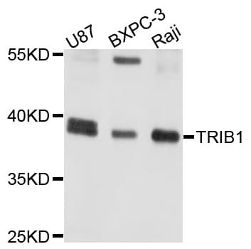 Polyclonal Rabbit anti-Human TRIB1 Antibody (WB)