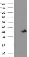 UNG / Uracil DNA Glycosylase Antibody (clone OTI1A6)