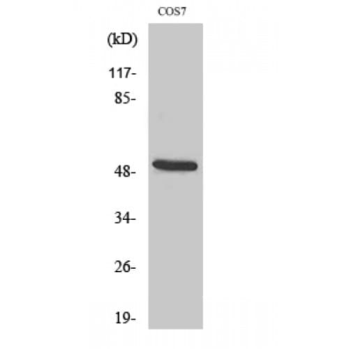 KRT15 / CK15 / Cytokeratin 15 Antibody (1-80 aa, N-terminal)
