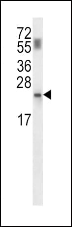 PPCDC Antibody (aa37-66)