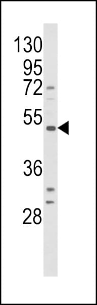 B1R / BDKRB1 Antibody (aa213-239)