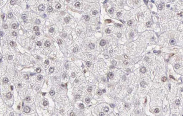 Polyclonal Rabbit anti-Human CASP10 / Caspase 10 Antibody (IHC, IF, WB)