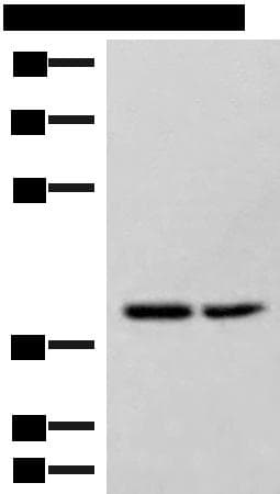 Polyclonal Rabbit anti-Human HPDL Antibody (WB)