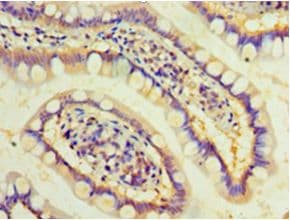 DAND5 Antibody (aa23-189)