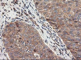 TFG Antibody (clone OTI2C3)