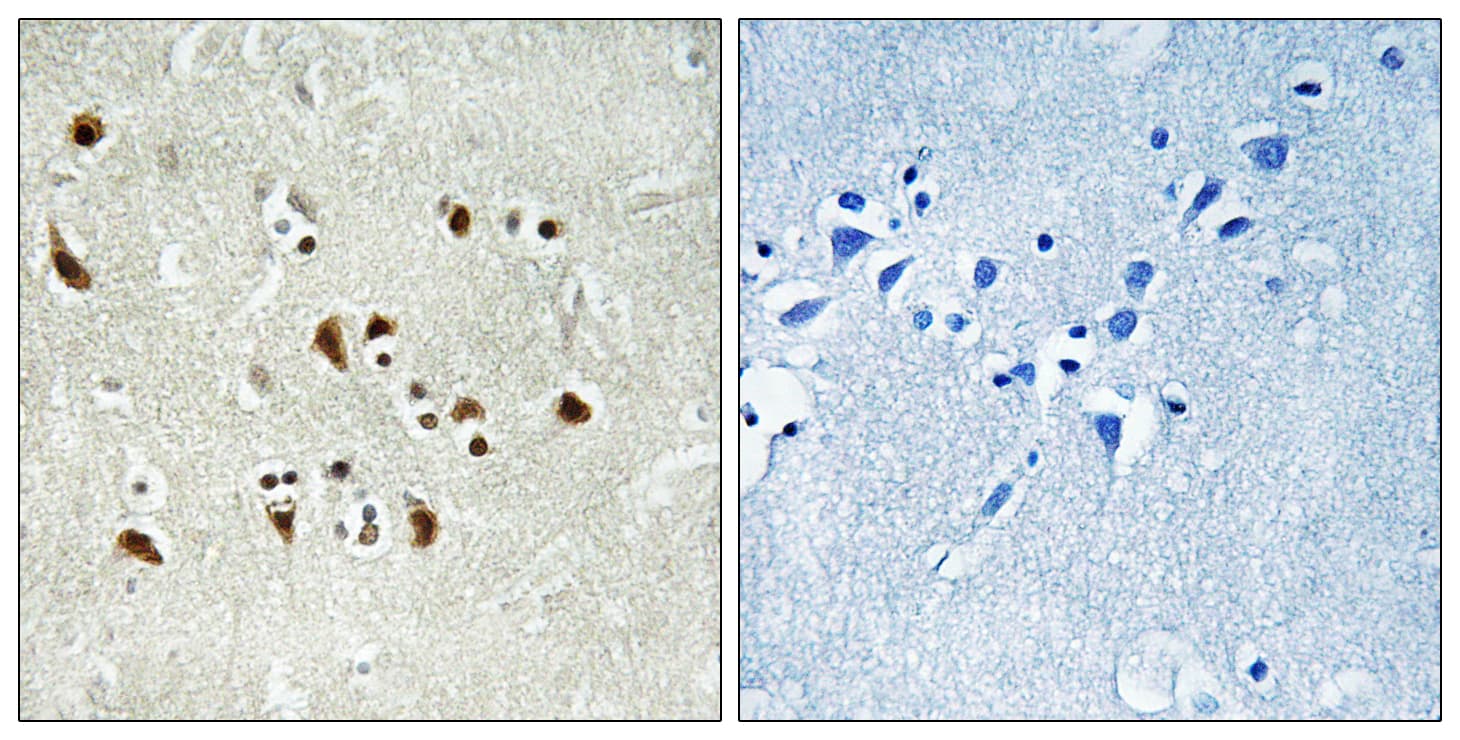 Polyclonal Rabbit anti-Human TUBGCP6 / GCP6 Antibody (aa741-790, IHC, WB)
