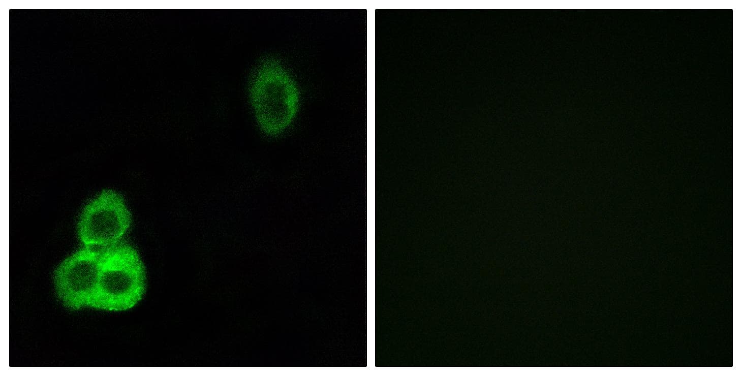 Polyclonal Rabbit anti-Human CELSR1 Antibody (IF)