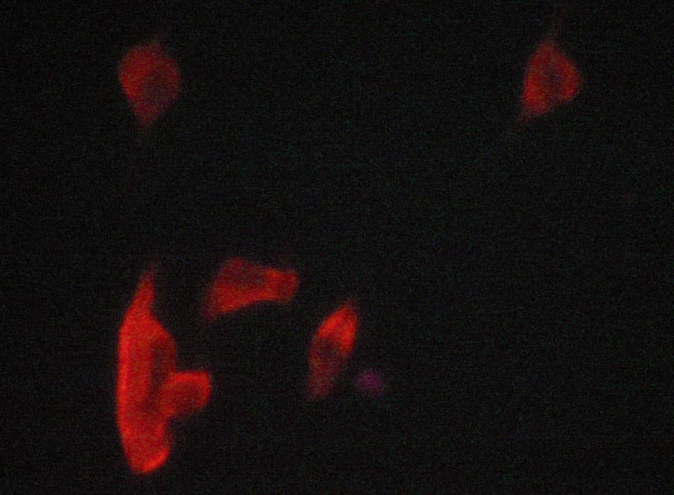 EIF2AK3 / PERK Antibody