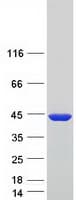 Human TPM2 Protein (Recombinant Myc-DDK (Flag))