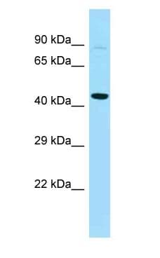 PFKFB4 Antibody (aa194-243)