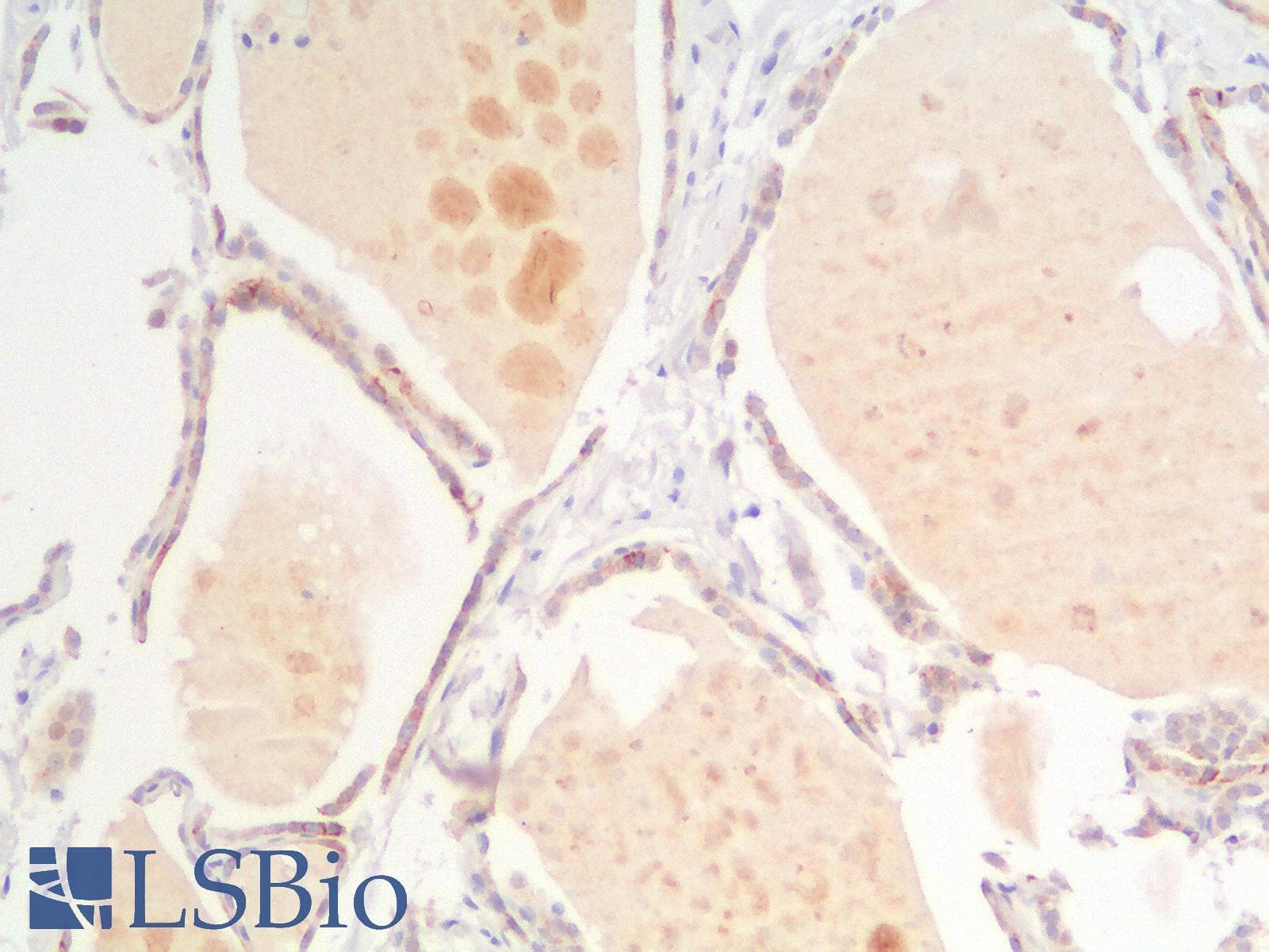 PathPlus™ Recombinant Monoclonal Mouse anti-Human CDH16 / Cadherin 16 Antibody (clone rCDH16/1071, IHC, WB)