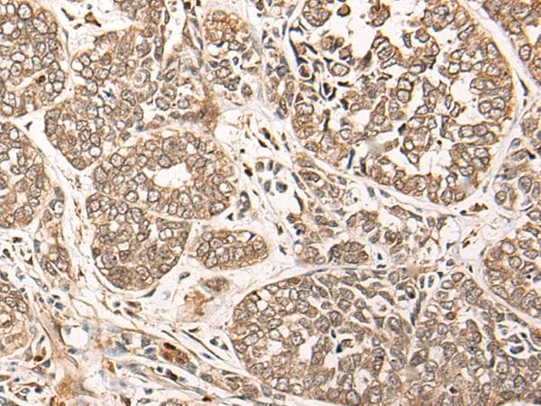 Polyclonal Rabbit anti-Human CA-VB / CA5B Antibody (IHC)