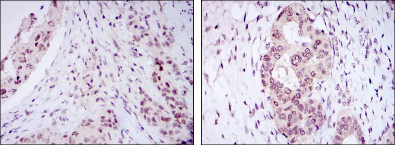 Monoclonal Mouse anti-Human NACC1 / NAC1 Antibody (clone 6H2, IHC, WB)