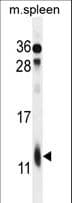 RPL39 / Ribosomal Protein L39 Antibody (aa15-42)