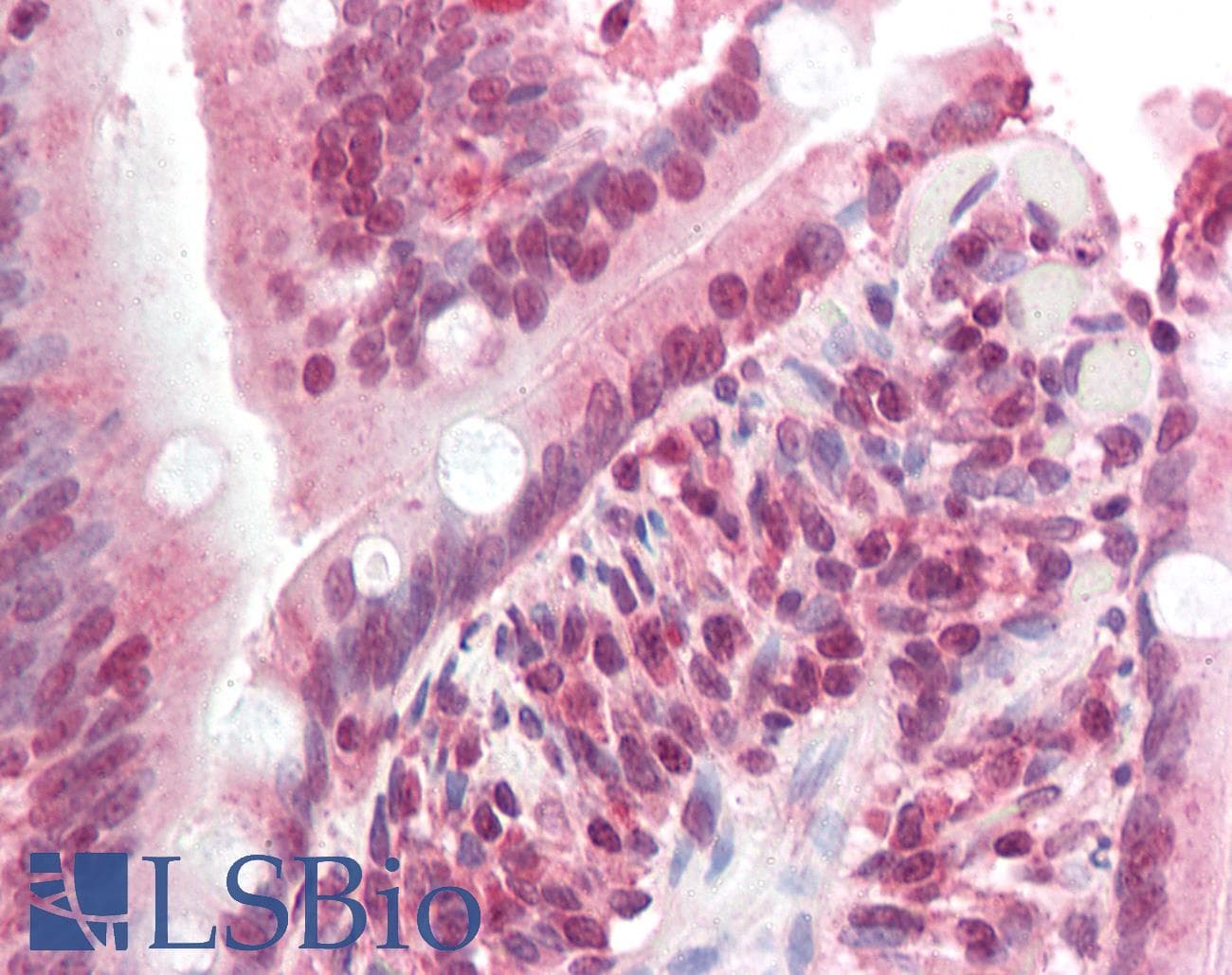 IHC-plus™ ZNF521 Antibody