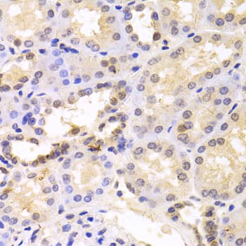 Polyclonal Rabbit anti-Human PSMC6 Antibody (IHC, WB)