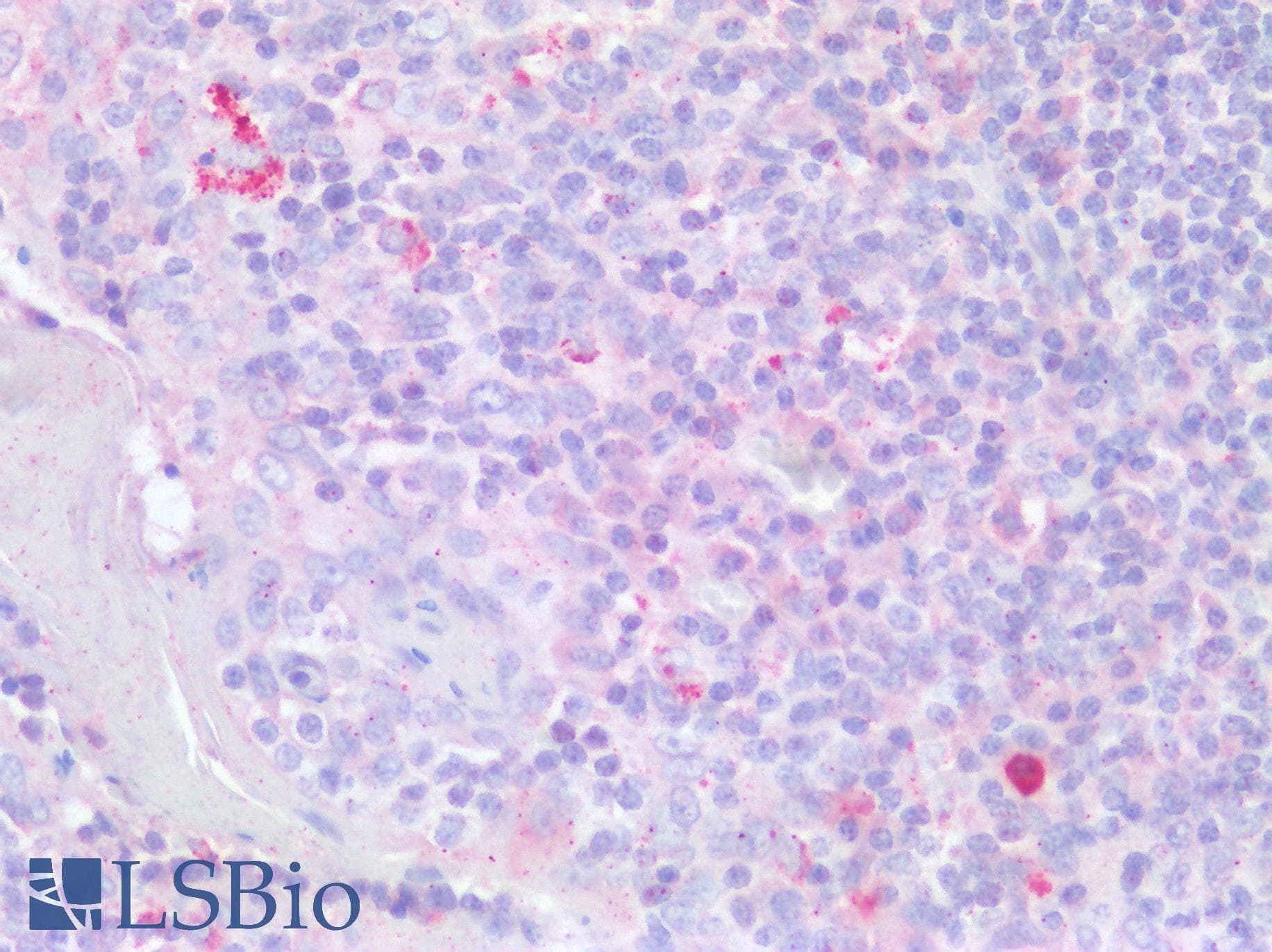 IHC-plus™ TLR8 Antibody