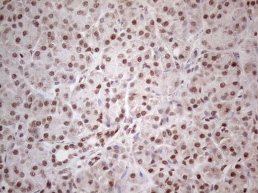 MLH1 Antibody (aa299-527, clone UMAB191)