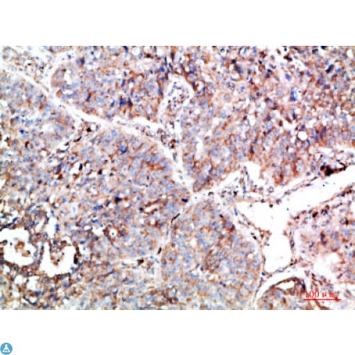 PTEN Antibody