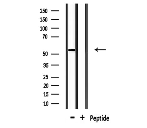 Polyclonal Rabbit anti-Human KRT12 / CK12 / Cytokeratin 12 Antibody (WB)