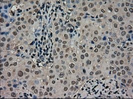 SCYL3 Antibody (clone OTI2H10)