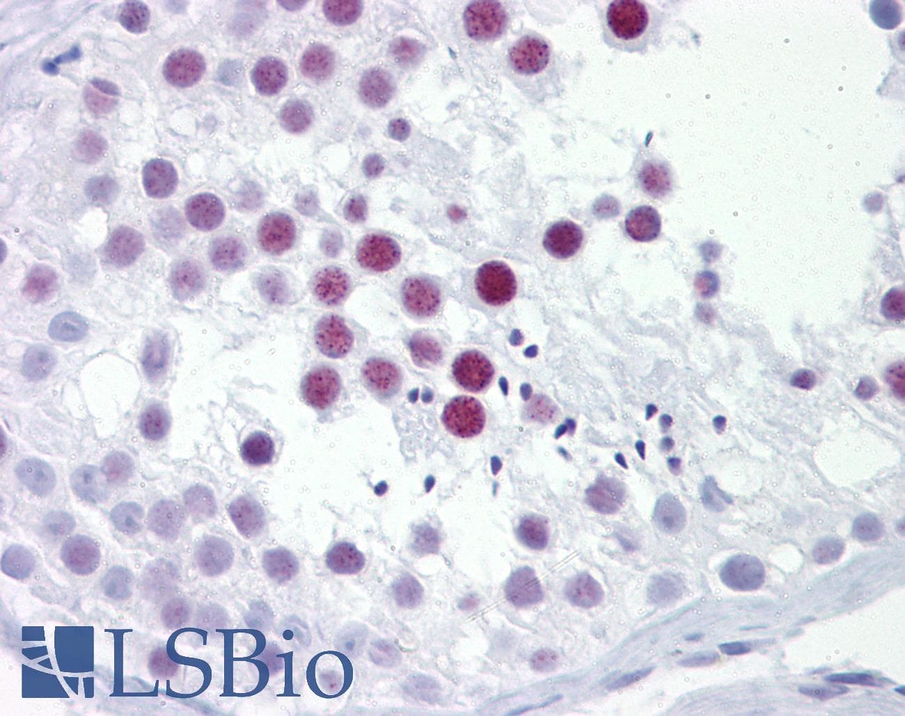 Polyclonal Rabbit anti-Human PHOX2A Antibody (aa72-121, IHC, WB)