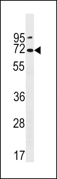 Polyclonal Rabbit anti-Human PKD2L2 Antibody (aa193-219, WB)