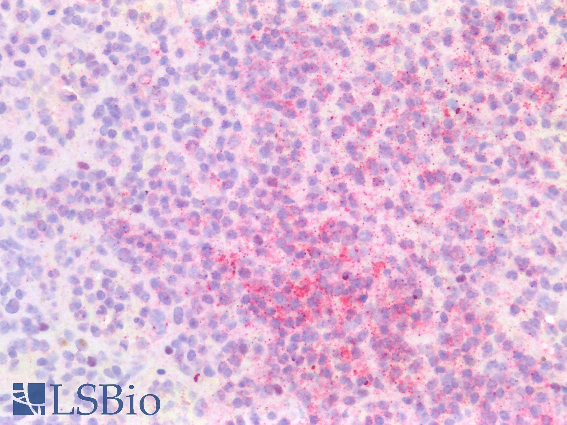 IHC-plus™ Polyclonal Goat anti-Human IRF4 Antibody (Amino Acids 393-407, IHC, WB)